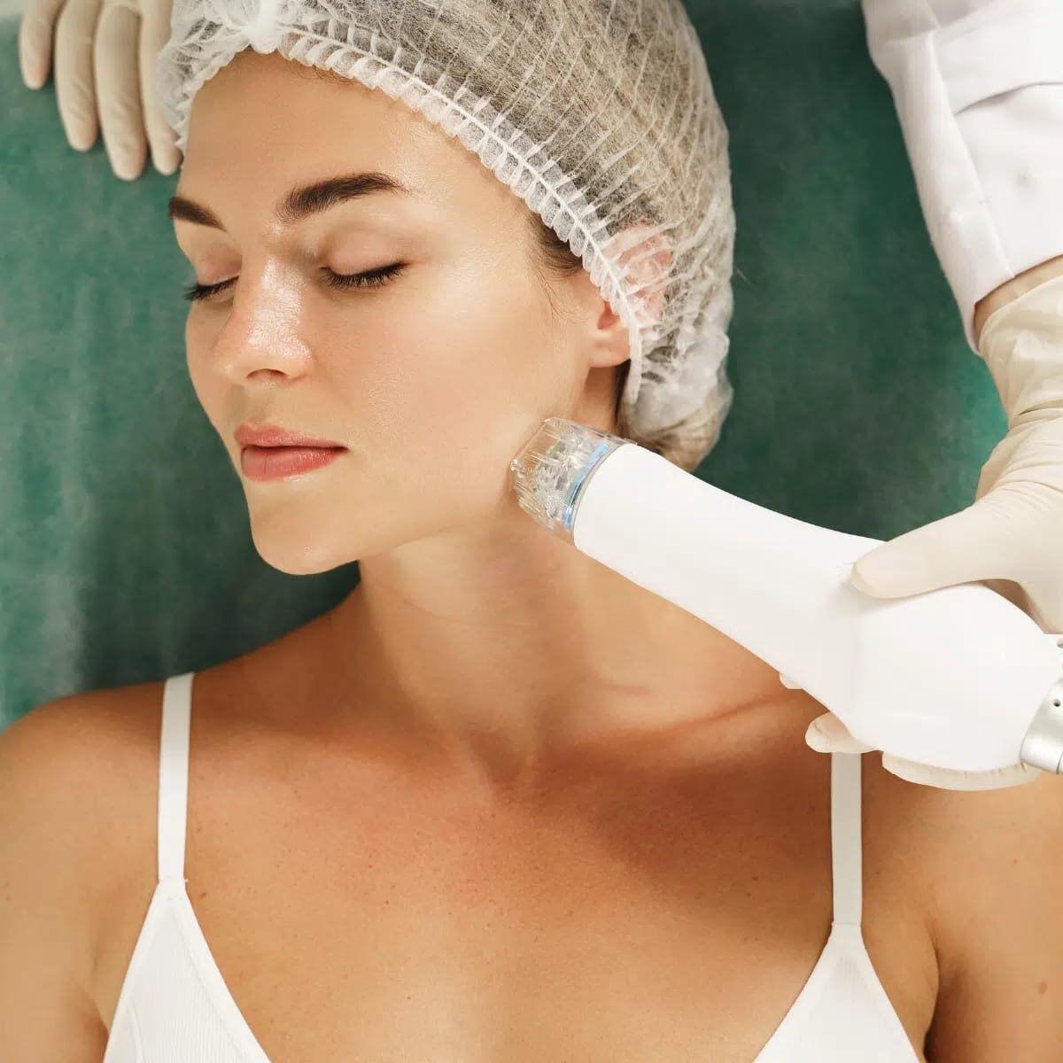 Radio Frequency Facial Ruined My Skin.